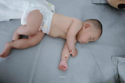 桐乡六个月宝宝眼睛散光